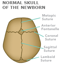 Illustration of a normal skull of a newborn