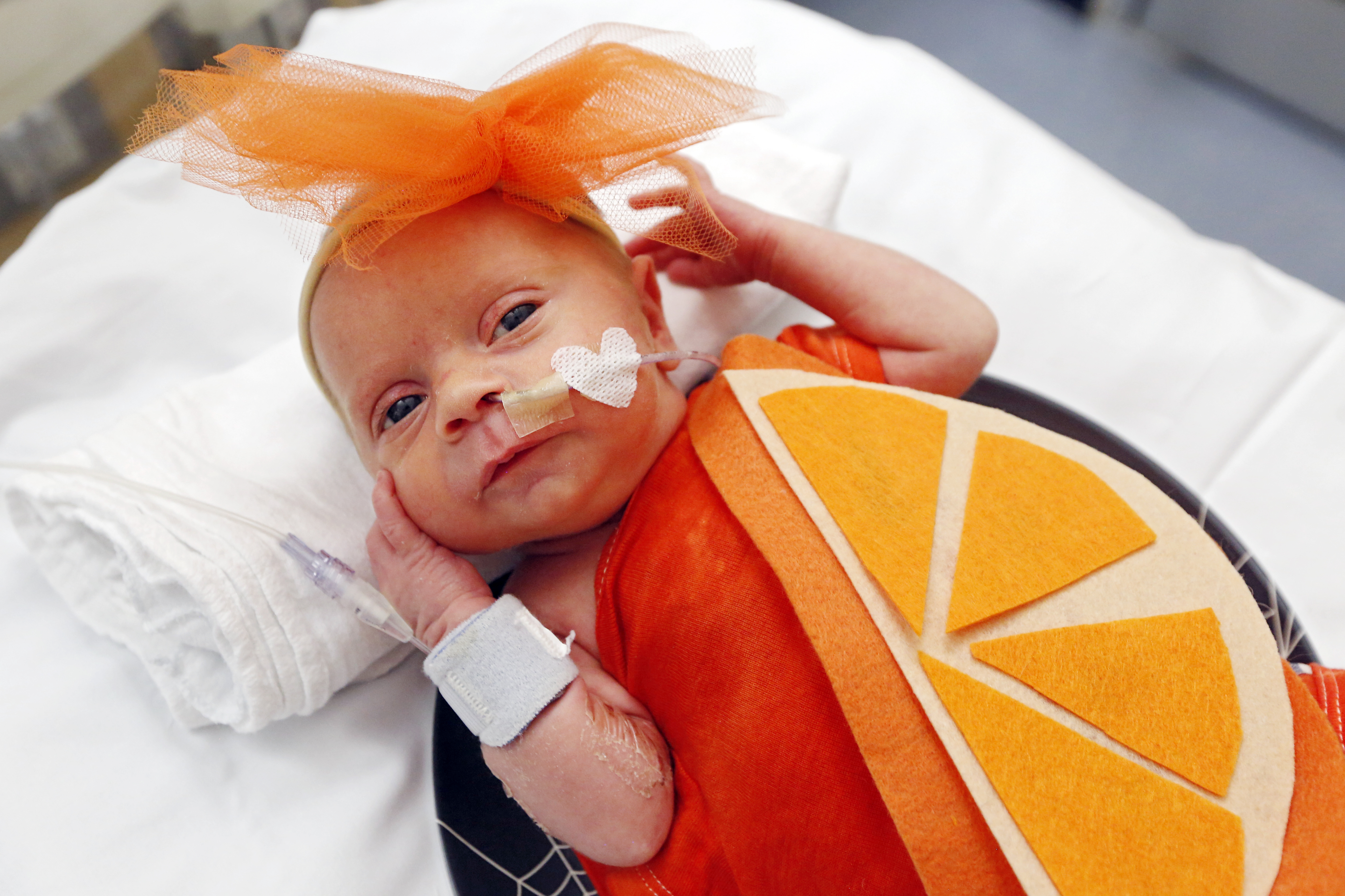 Baby dressed up as orange in NICU